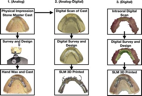 fabrication process of a cast metal partial denture ppt|cast partial denture lab procedures.